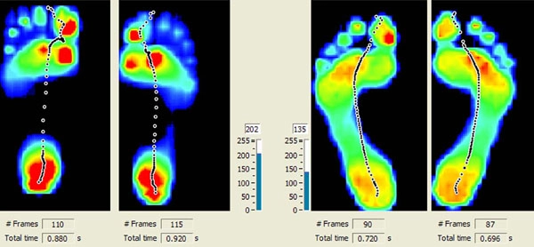 Chiropractic University Place WA Scan